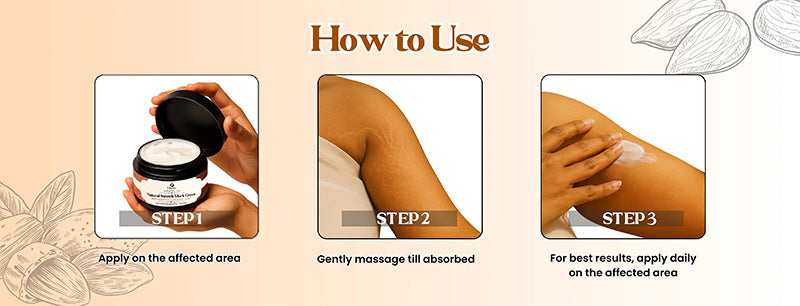 💖Mother’s Day Special: Virexo Stretch Mark Cream –––Give Mom the Skin She Deserves 💖