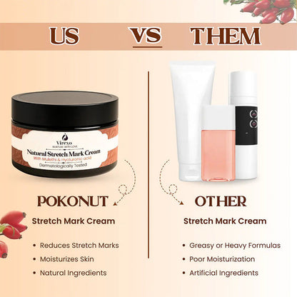 💖Mother’s Day Special: Virexo Stretch Mark Cream –––Give Mom the Skin She Deserves 💖