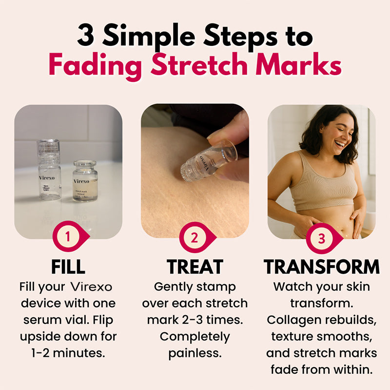 💖Virexo Stretch Mark System🌸 Safe for postpartum & breastfeeding moms