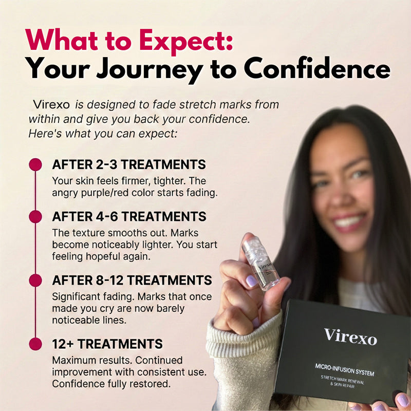 💖Virexo Stretch Mark System🌸 Safe for postpartum & breastfeeding moms