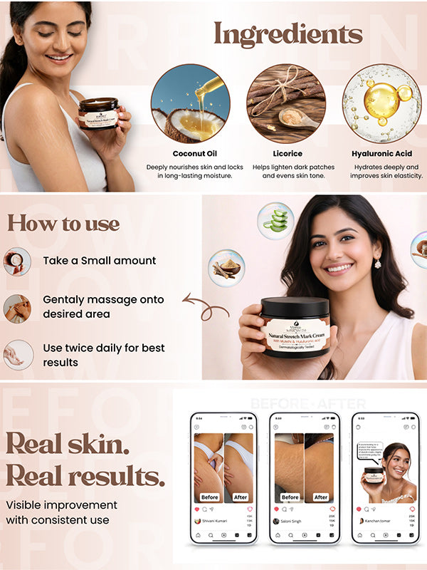 💖Mother’s Day Special: Virexo Stretch Mark Cream –––Give Mom the Skin She Deserves 💖
