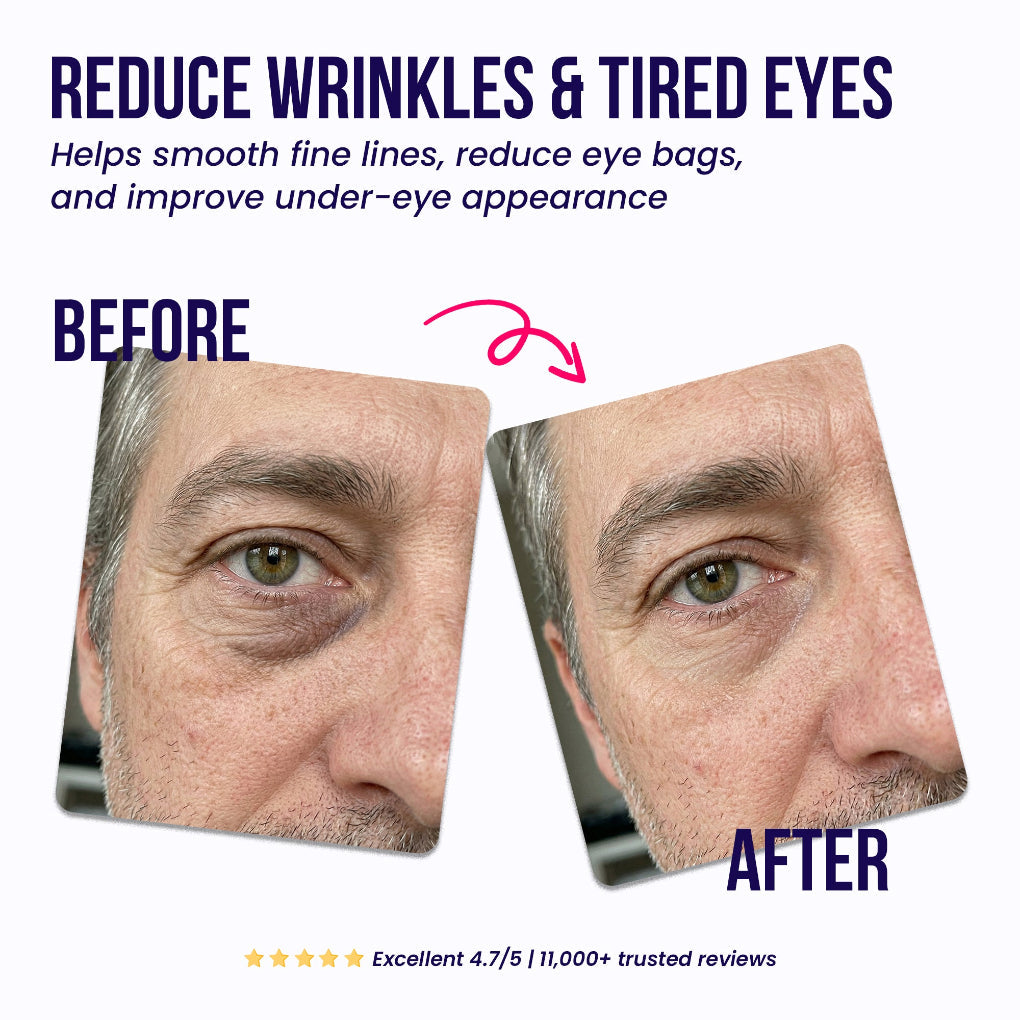 🎁Mother's Day Special 70% OFF🔥Under-Eye Repair Patches