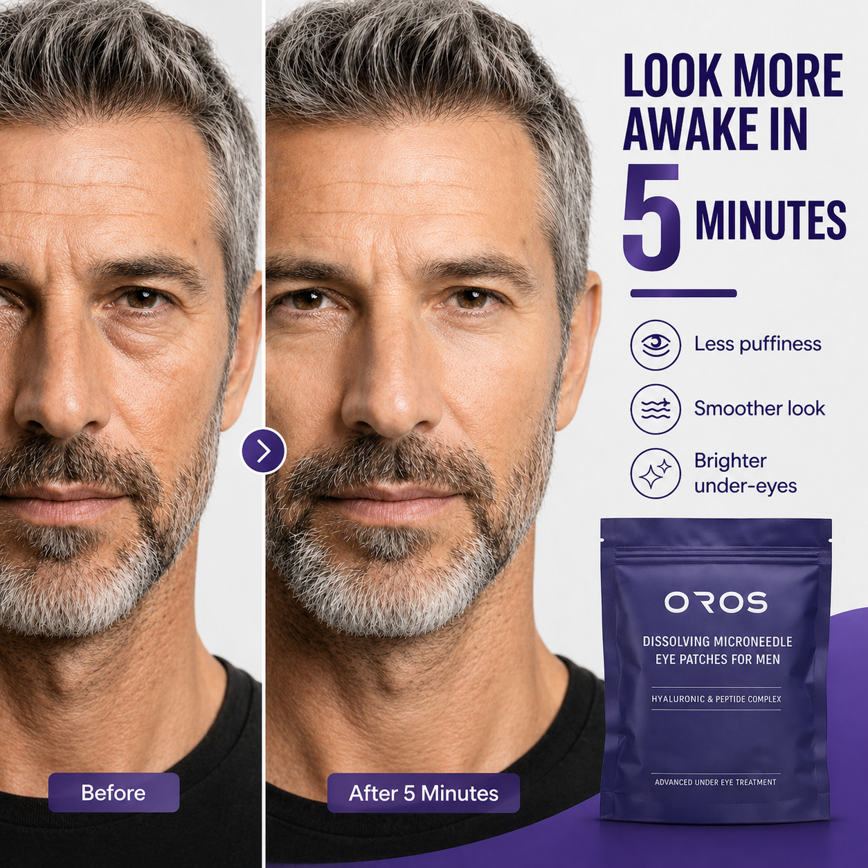 🎁Mother's Day Special 70% OFF🔥Under-Eye Repair Patches